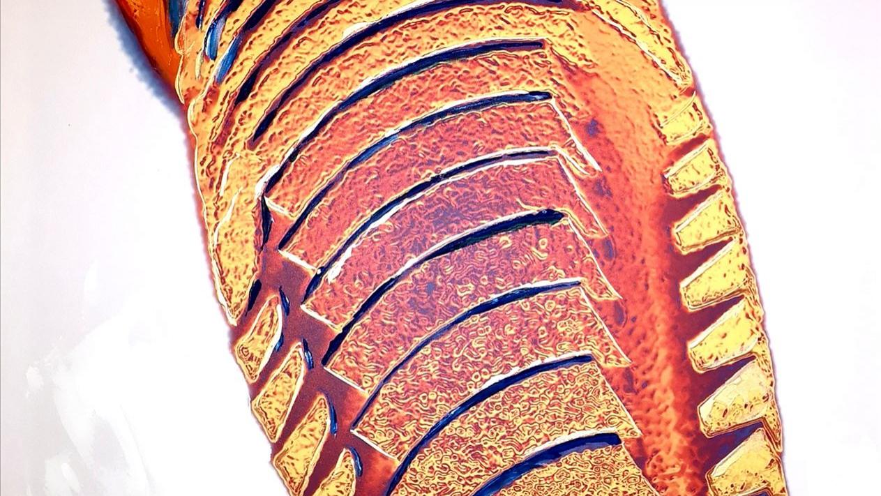 Kunst-Implantat-K3pro